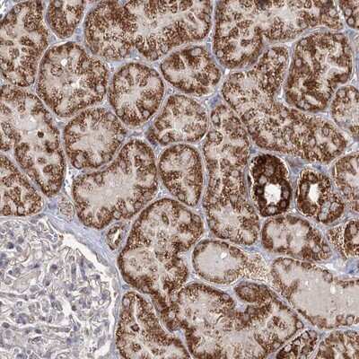 Immunohistochemistry-Paraffin: CBR4 Antibody [NBP1-82235]