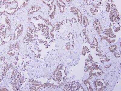 Immunohistochemistry-Paraffin: CBR4 Antibody [NBP2-15734]