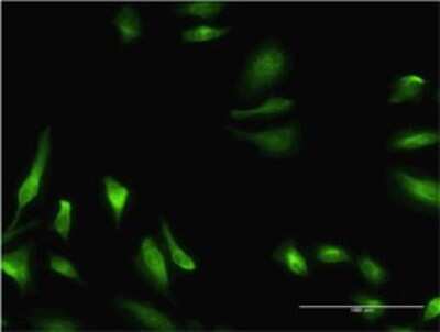 Immunocytochemistry/ Immunofluorescence: CBS Antibody (3D10) [H00000875-M02]