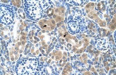 Immunohistochemistry-Paraffin: CBS Antibody [NBP1-52850]