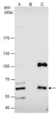 Immunoprecipitation: CBS Antibody [NBP1-33518]