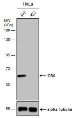 Knockout Validated: CBS Antibody [NBP1-33518]