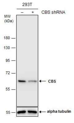 Knockdown Validated: CBS Antibody [NBP1-33518]