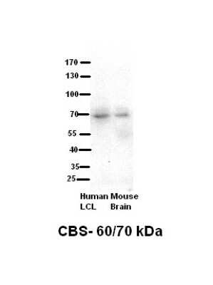 Western Blot: CBS Antibody [NBP1-52850]