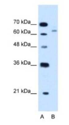 Western Blot: CBS Antibody [NBP1-52850]