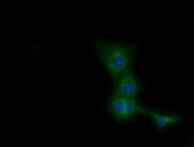 Immunocytochemistry/ Immunofluorescence: CBWD1 Antibody (OTI4D4) [NBP2-02931]