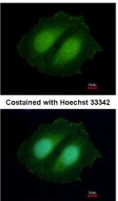 Immunocytochemistry/ Immunofluorescence: CBWD1 Antibody [NBP2-14898]