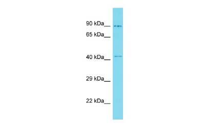 Western Blot: CBWD3 Antibody [NBP3-09661]