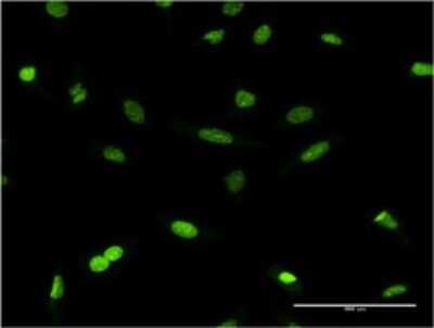 Immunocytochemistry/ Immunofluorescence: CBX1 Antibody (4E12) [H00010951-M01]
