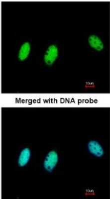 Immunocytochemistry/ Immunofluorescence: CBX1 Antibody [NBP2-14900]
