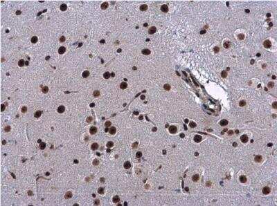 Immunohistochemistry-Paraffin: CBX1 Antibody [NBP2-14899]