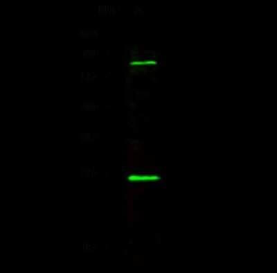 Western Blot: CBX1 Antibody [NBP2-98755]