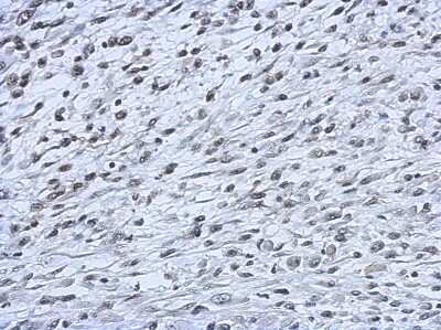 Immunohistochemistry-Paraffin: Cbx2 Antibody [NBP2-15735]