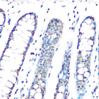 Immunohistochemistry-Paraffin: CBX3 Antibody (7B7Q2) [NBP3-16368]