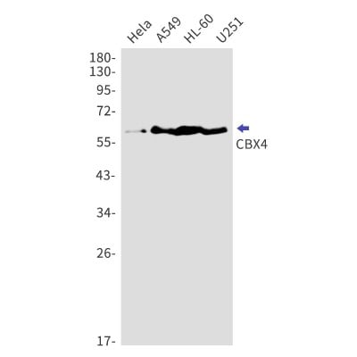 Western Blot: CBX4 Antibody (S07-2F2) [NBP3-19821]
