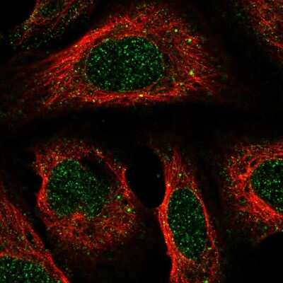 Immunocytochemistry/ Immunofluorescence: CC Chemokine Receptor D6 Antibody [NBP2-57954]