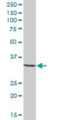 Western Blot: CC Chemokine Receptor D6 Antibody [H00001238-B01P]