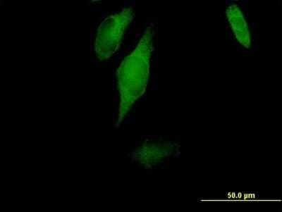 Immunocytochemistry/ Immunofluorescence: CC2D1A Antibody [H00054862-B01P]