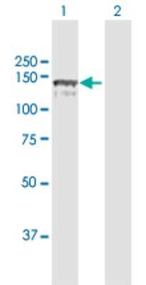 Western Blot: CC2D1A Antibody [H00054862-D01P]