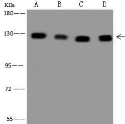 Western Blot: CC2D1A Antibody [NBP3-12658]