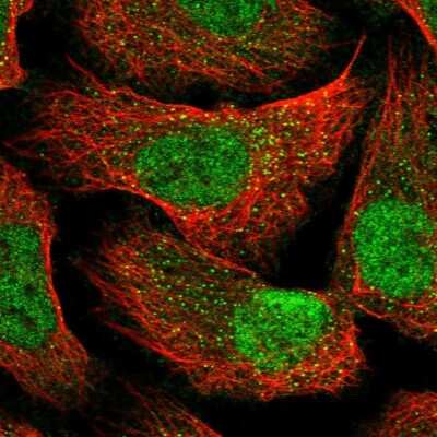 Immunocytochemistry/ Immunofluorescence: CC2D1B Antibody [NBP2-58794]