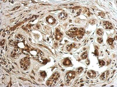 Immunohistochemistry-Paraffin: CC2D2B Antibody [NBP2-15738]