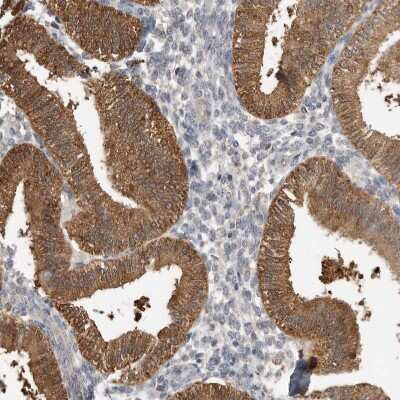 Immunohistochemistry-Paraffin: CCBL2 Antibody [NBP1-87387]