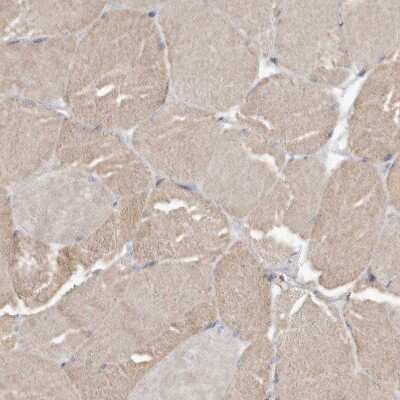 Immunohistochemistry-Paraffin: CCBL2 Antibody [NBP1-87387]