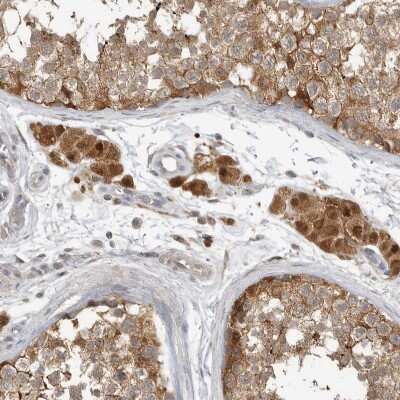 Immunohistochemistry-Paraffin: CCBL2 Antibody [NBP1-87387]
