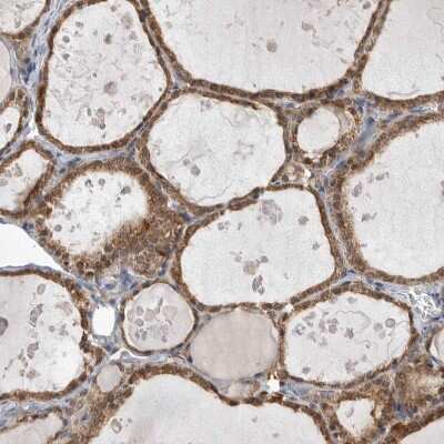 Immunohistochemistry-Paraffin: CCBL2 Antibody [NBP1-87387]