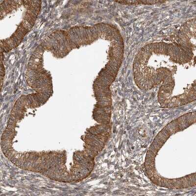 Immunohistochemistry-Paraffin: CCBL2 Antibody [NBP1-87388]