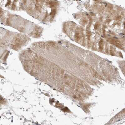 Immunohistochemistry-Paraffin: CCBL2 Antibody [NBP1-87388]