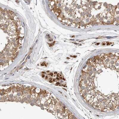 Immunohistochemistry-Paraffin: CCBL2 Antibody [NBP1-87388]