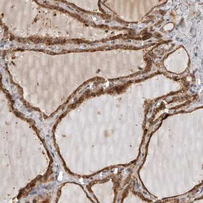 Immunohistochemistry-Paraffin: CCBL2 Antibody [NBP1-87388]