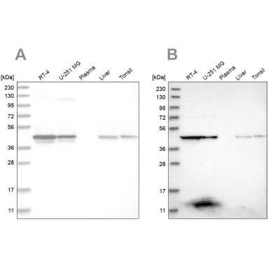 Western Blot: CCBL2 Antibody [NBP1-87387]