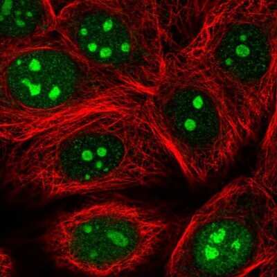 Immunocytochemistry/ Immunofluorescence: CCDC101 Antibody [NBP2-38670]
