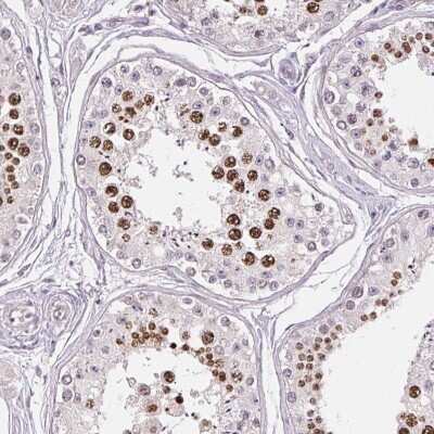 Immunohistochemistry-Paraffin: CCDC101 Antibody [NBP2-38670]