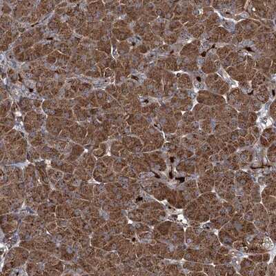 Immunohistochemistry-Paraffin: CCDC102A Antibody [NBP1-82766]