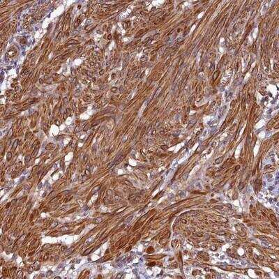 Immunohistochemistry-Paraffin: CCDC102B Antibody [NBP1-89260]