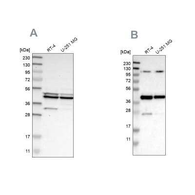 Western Blot: CCDC104 Antibody [NBP1-93513]