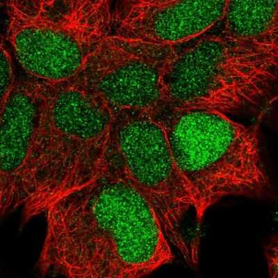 Immunocytochemistry/ Immunofluorescence: CCDC106 Antibody [NBP2-30390]