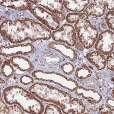 Immunohistochemistry-Paraffin: CCDC106 Antibody [NBP2-30390]
