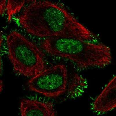 Immunocytochemistry/ Immunofluorescence: CCDC107 Antibody [NBP2-58785]