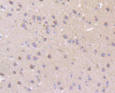 Immunohistochemistry: CCDC109A Antibody [NBP2-76948]