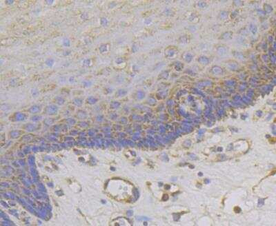 Immunohistochemistry: CCDC109A Antibody [NBP2-76948]