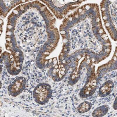 Immunohistochemistry-Paraffin: CCDC109A Antibody [NBP1-88534]