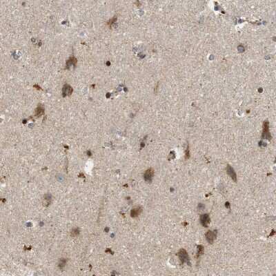 Immunohistochemistry-Paraffin: CCDC109A Antibody [NBP1-88534]