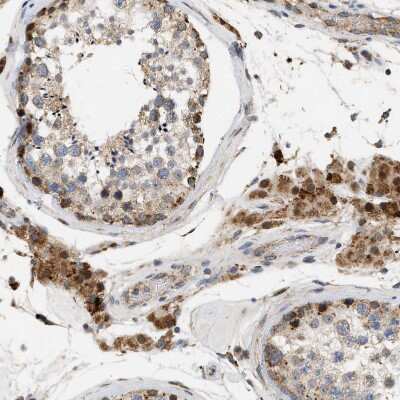Immunohistochemistry-Paraffin: CCDC109A Antibody [NBP1-88534]