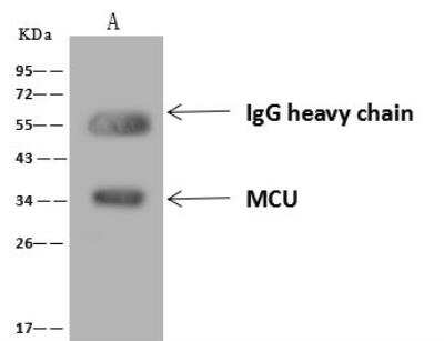 Immunoprecipitation: CCDC109A Antibody [NBP3-12716]