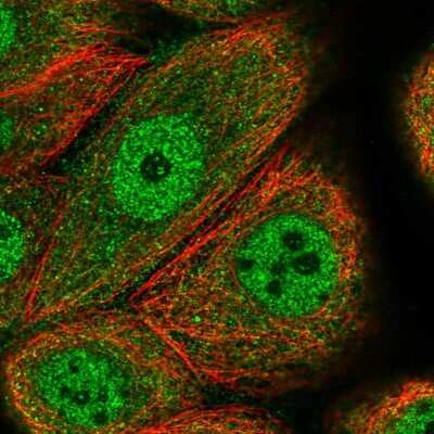 Immunocytochemistry/ Immunofluorescence: CCDC112 Antibody [NBP2-14442]